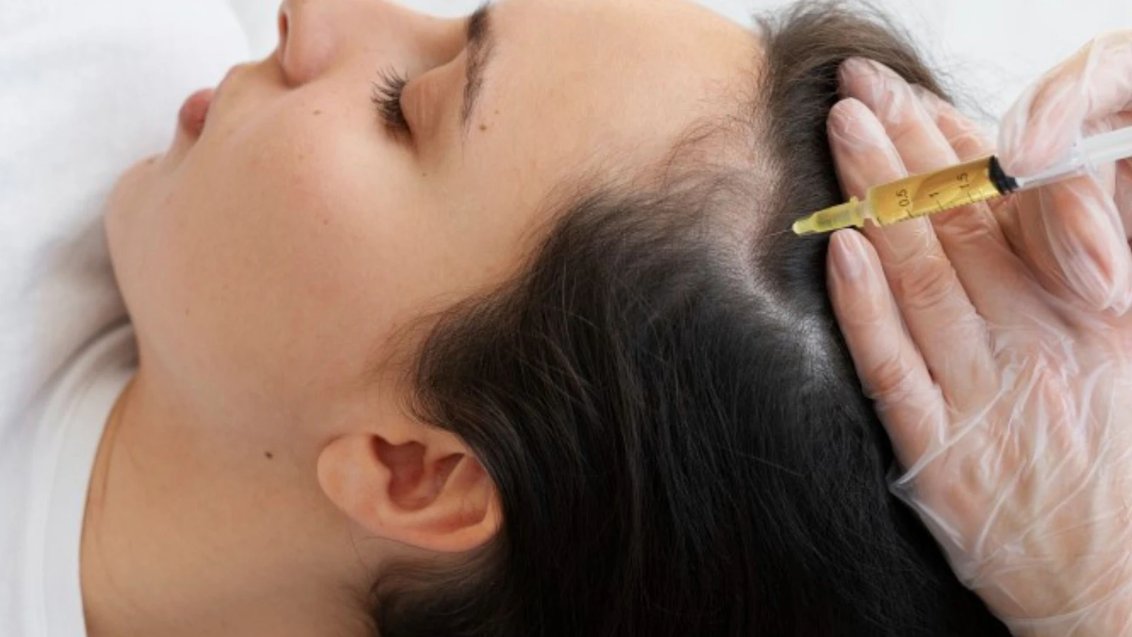 Woman receiving a clinical hair growth treatment, representing evidence-based options for hair loss